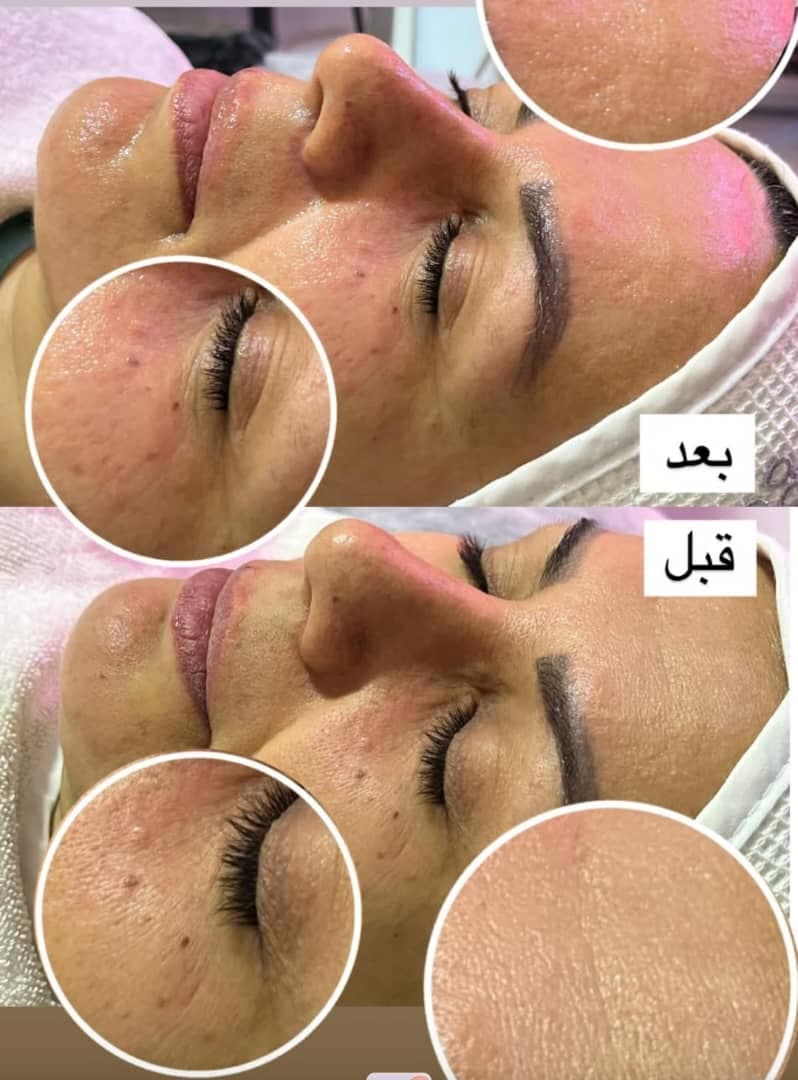 آموزش خدمات پاکسازی و مراقبت از پوست زینب نبی زاده در بابل