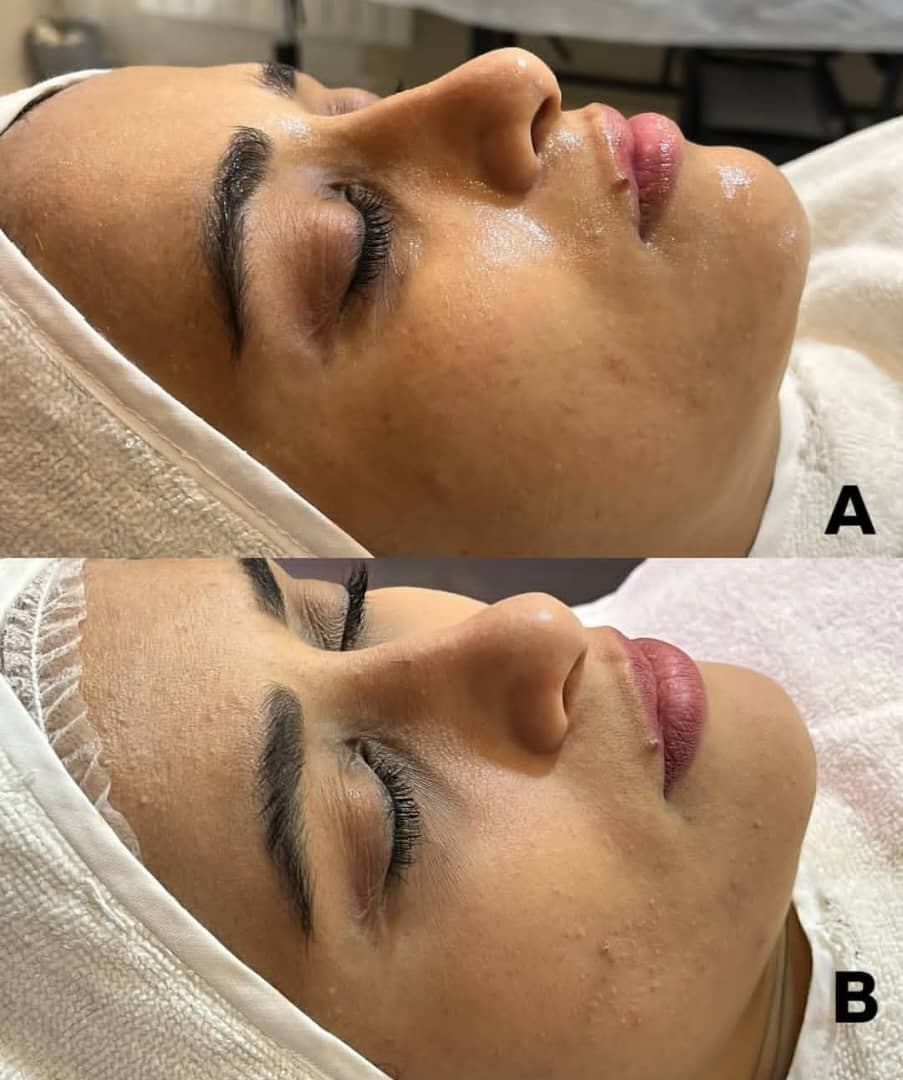 آموزش خدمات پاکسازی و مراقبت از پوست زینب نبی زاده در بابل