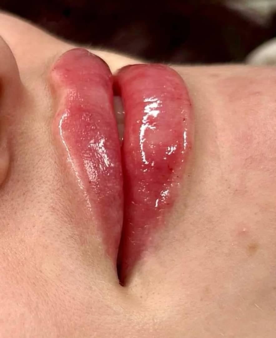 آموزش و خدمات تخصصی تزریق فیلر و بوتاکس هستی قپانوری در کرمانشاه