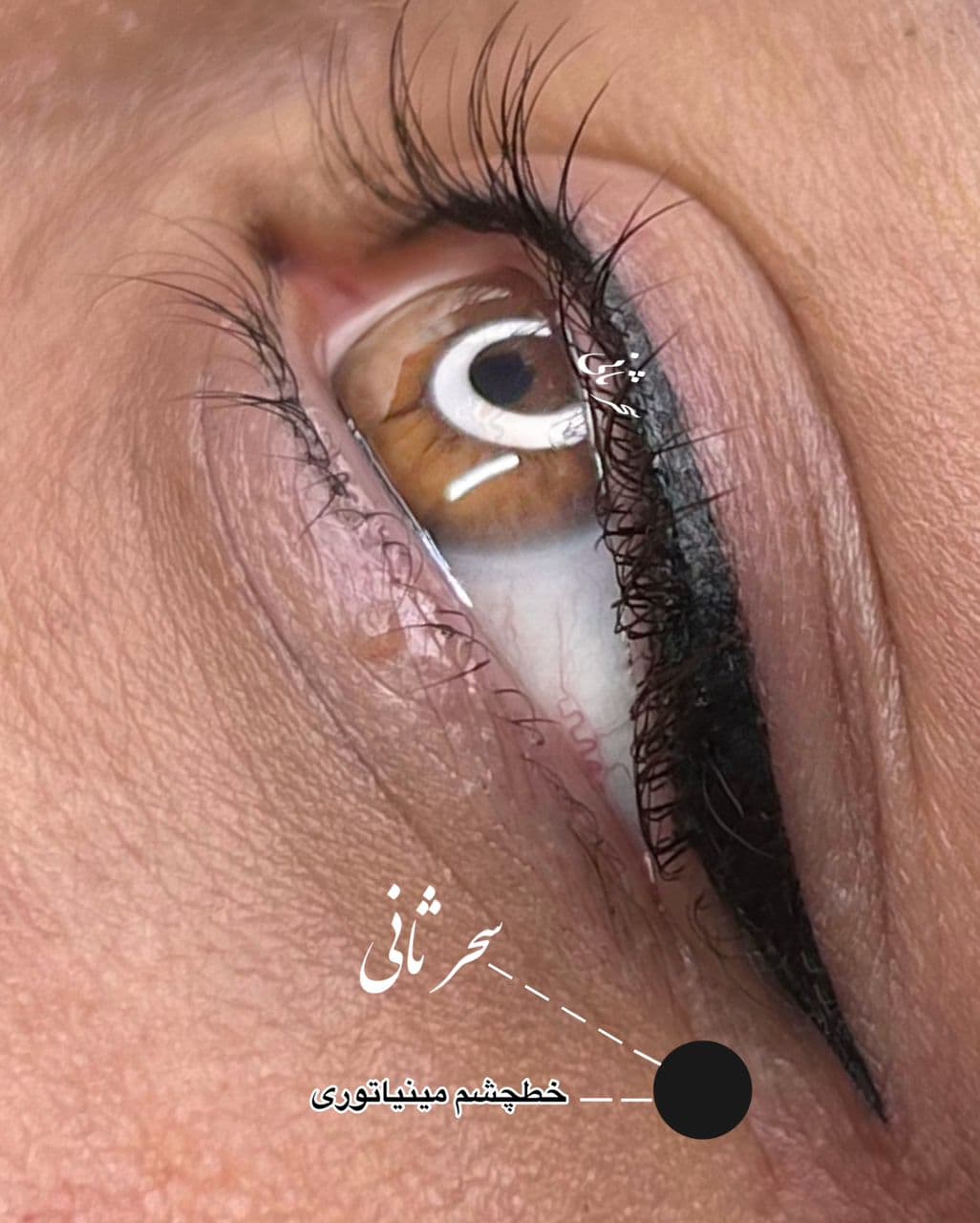 میکروپیگمنتیشن صورت و میکروبلیدینگ سحر ثانی در رشت