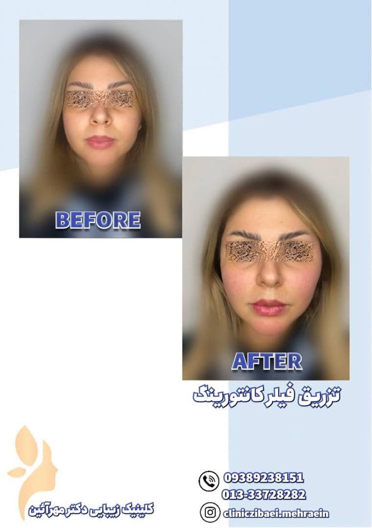 کلینیک زیبایی و جوانسازی و لاغری و لیزر موهای زائد دکتر مهرآئین در رشت