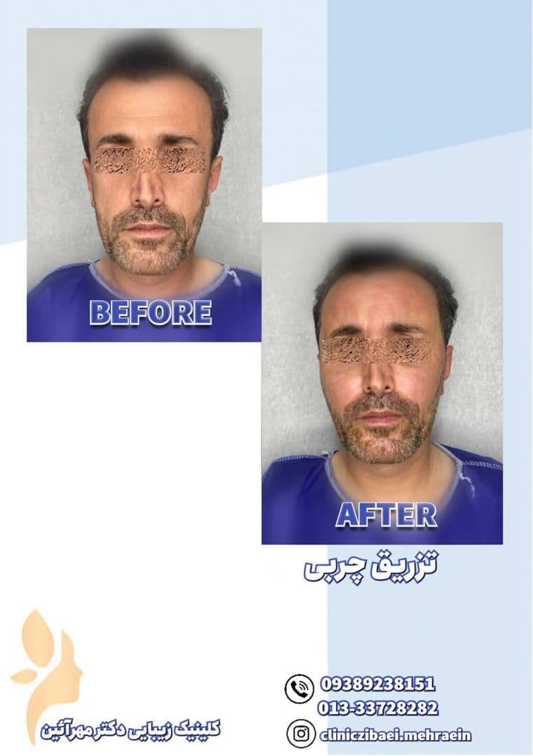 کلینیک زیبایی و جوانسازی و لاغری و لیزر موهای زائد دکتر مهرآئین در رشت