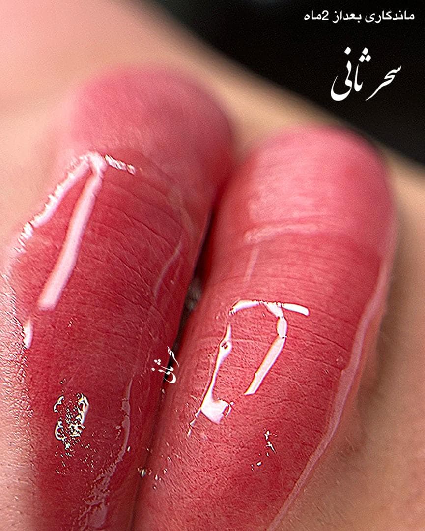 میکروپیگمنتیشن صورت و میکروبلیدینگ سحر ثانی در رشت