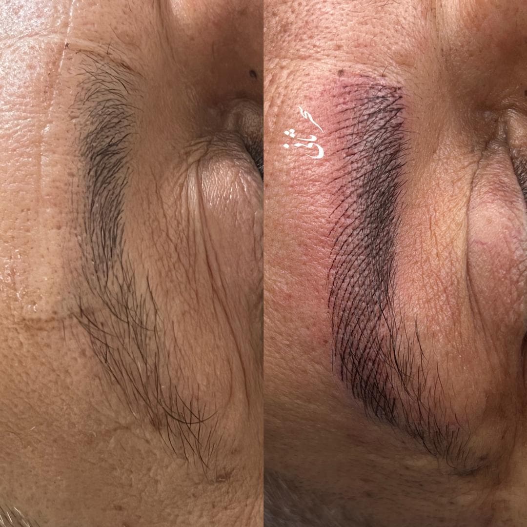 میکروپیگمنتیشن صورت و میکروبلیدینگ سحر ثانی در رشت