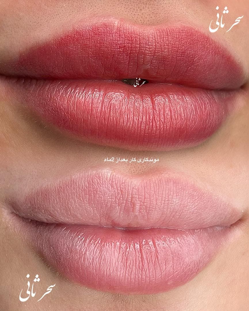 میکروپیگمنتیشن صورت و میکروبلیدینگ سحر ثانی در رشت