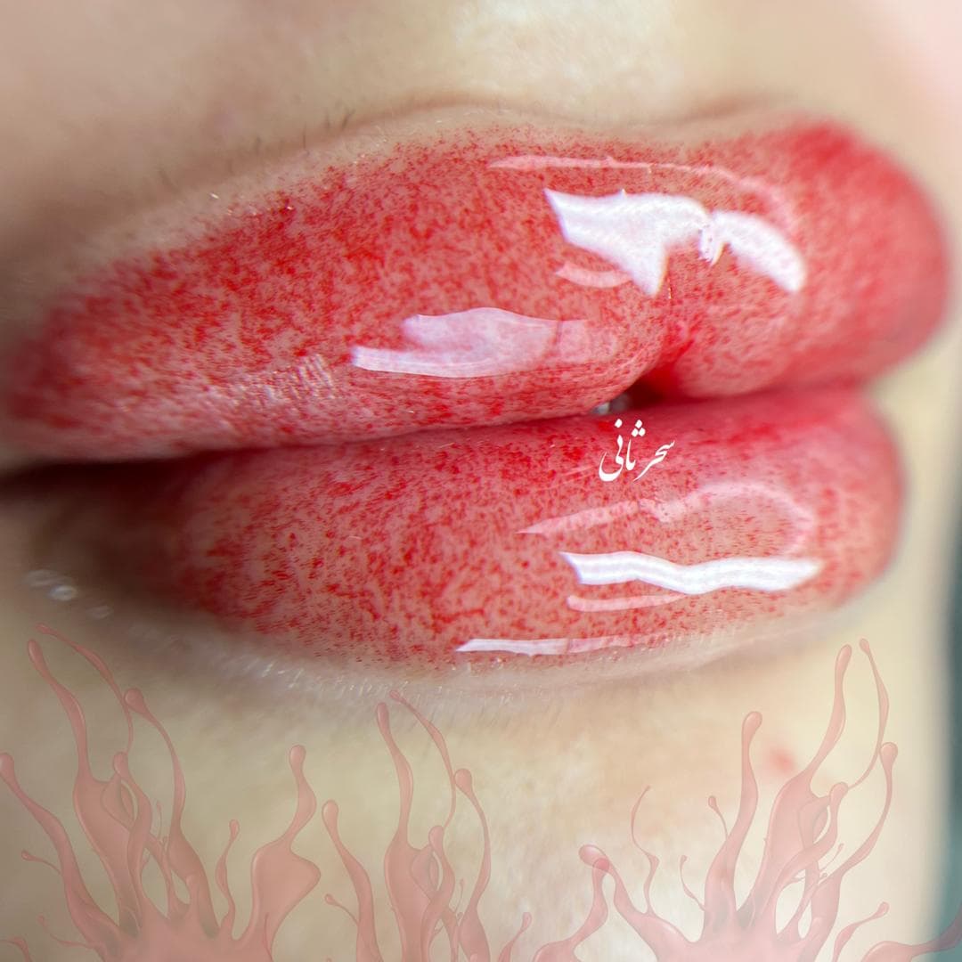 میکروپیگمنتیشن صورت و میکروبلیدینگ سحر ثانی در رشت