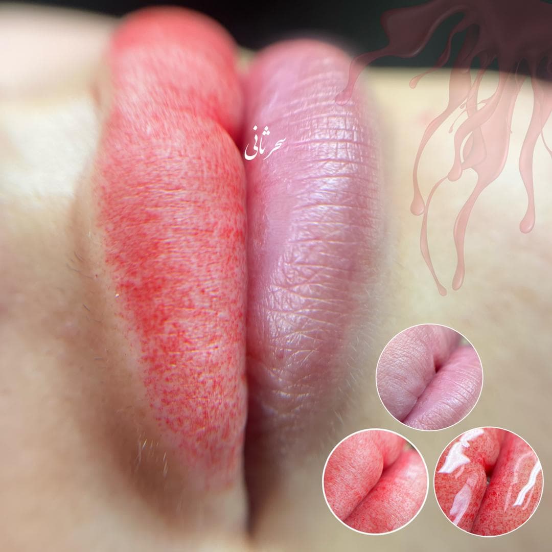 میکروپیگمنتیشن صورت و میکروبلیدینگ سحر ثانی در رشت