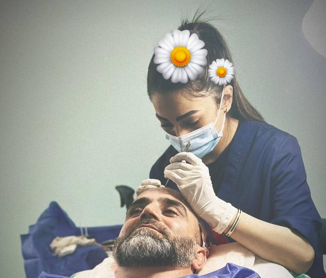 خدمات تخصصی کاشت مو به روش fit ماندانا حاجی در بابل