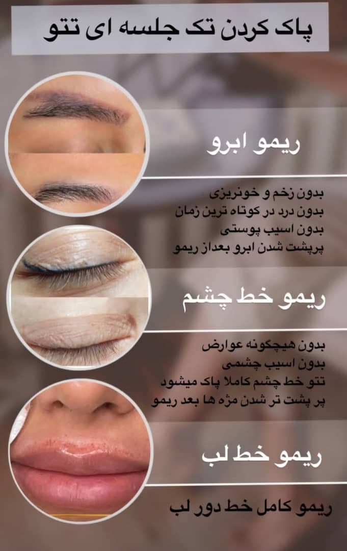 آموزش خدمات تخصصی آرایش دائم و ریمو تاتو شری خلیلی در شیراز
