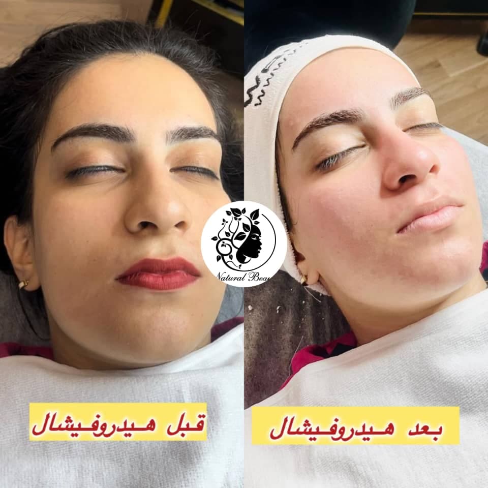 کلینیک زیبایی پوست و مو نچرال بیوتی دکتر رضاخانی در حکیم نظامی اصفهان