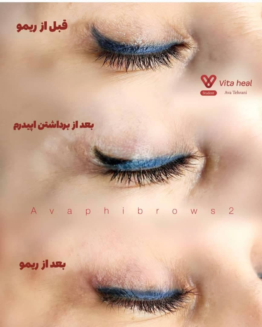 ارائه خدمات آرایش دائم و ریمو آوا طهرانی در شهر ری