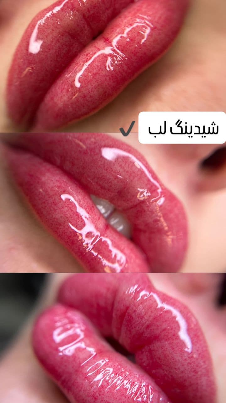 مرکز تخصصی اسکالپ کف سر نازنین طهماسبی در نجف آباد