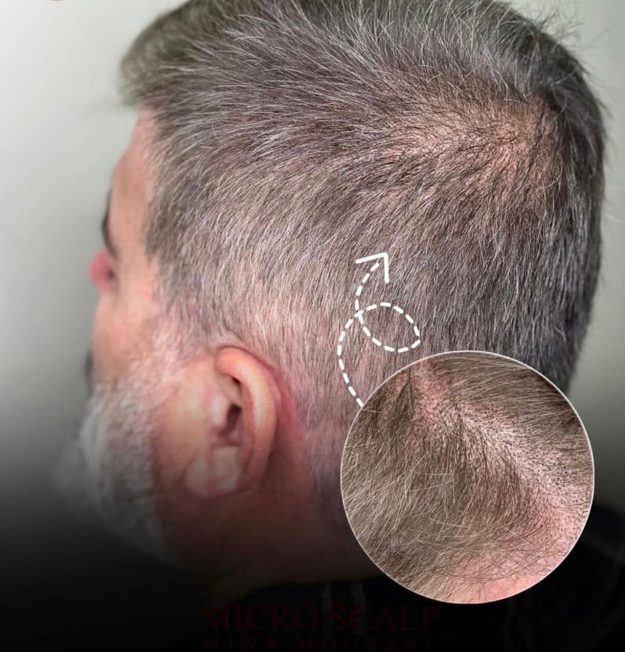 مرکز تخصصی اسکالپ کف سر نازنین طهماسبی در نجف آباد