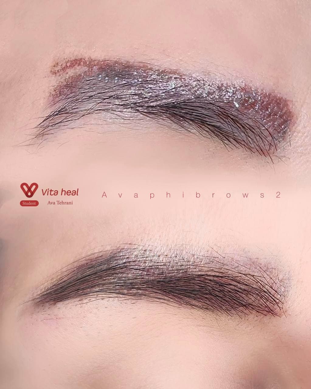 ارائه خدمات آرایش دائم و ریمو آوا طهرانی در شهر ری