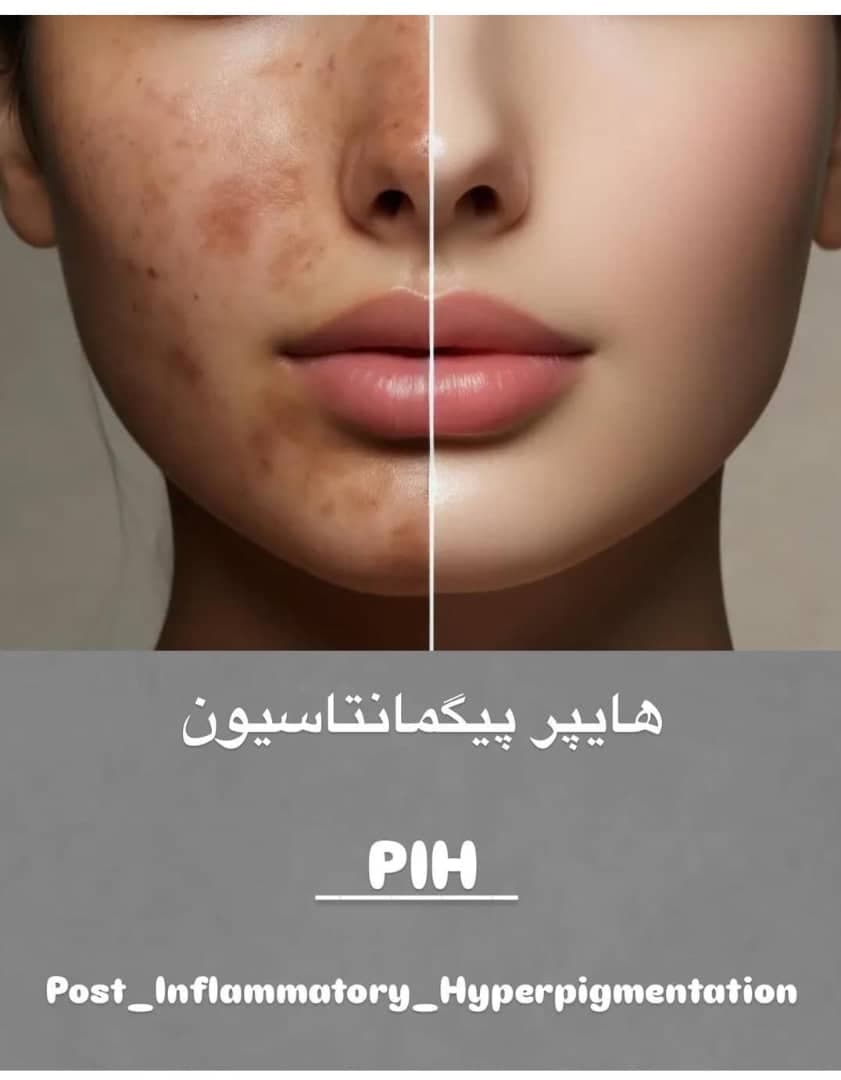 کلینیک لیزر و زیبایی الهام رشت