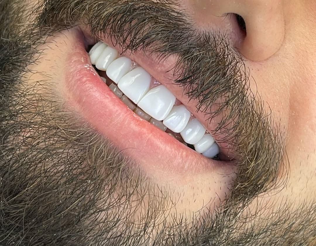 مطب دندانپزشکی و کامپوزیت تخصصی دکتر امین موسوی در اهواز