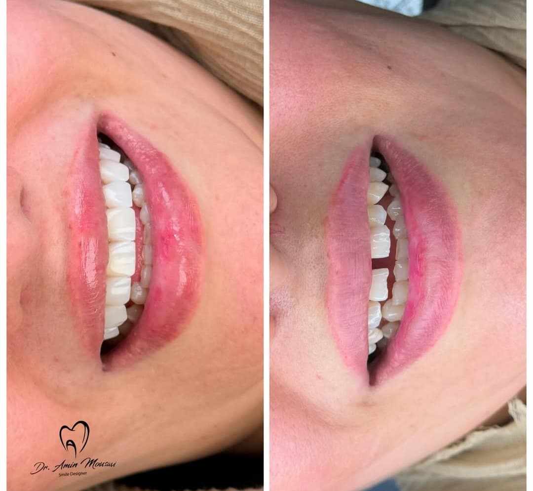 مطب دندانپزشکی و کامپوزیت تخصصی دکتر امین موسوی در اهواز