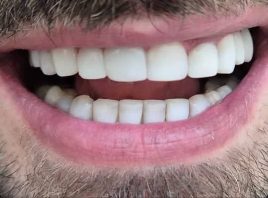 دندانپزشکی مروادنت به مدیریت دکتر بردبار و خان احمدی در کیانشهر تهران