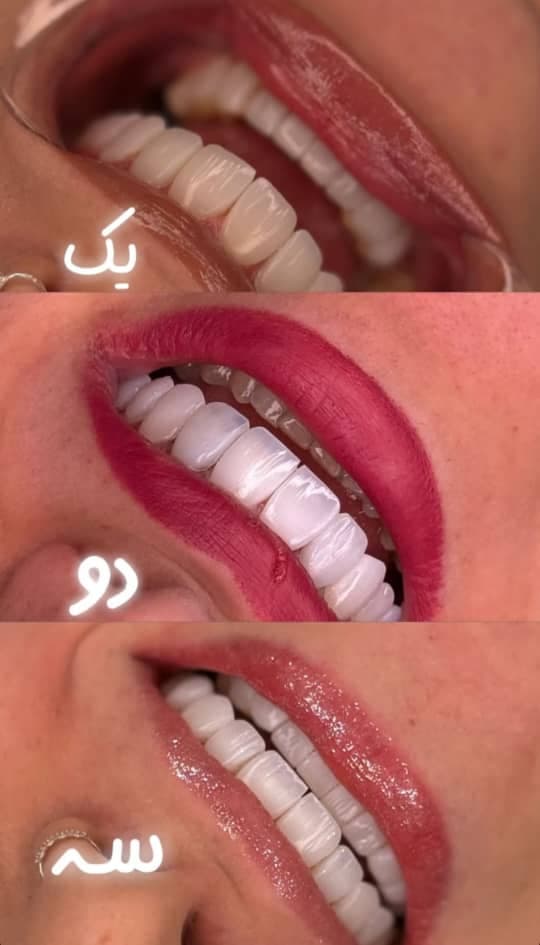 دندانپزشکی مروادنت به مدیریت دکتر بردبار و خان احمدی در کیانشهر تهران